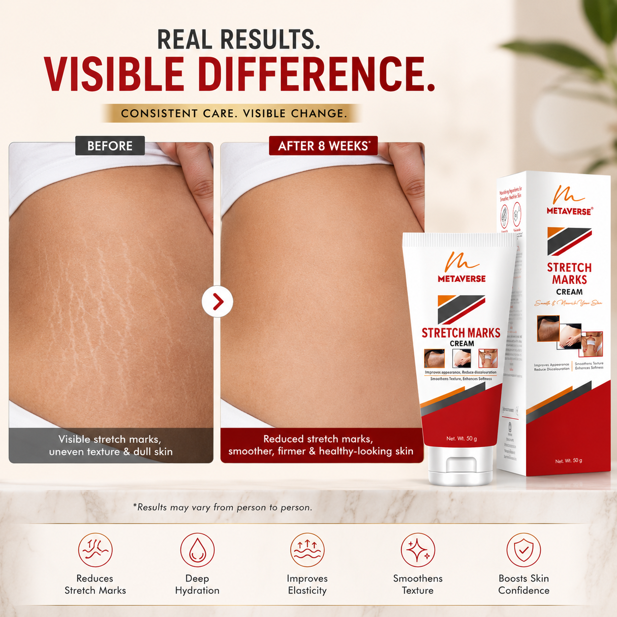 Metaverse Stretch Marks Cream for Women & Men – Skin Repair, Hydration & Smoothing Formula for Pregnancy & Weight Loss Marks